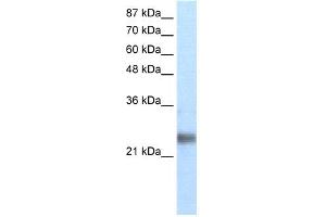 WB Suggested Anti-ZNF313 Antibody Titration: 1. (RNF114 抗体  (N-Term))