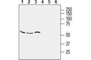 Western blot analysis of human SH-SY5Y neuroblastoma (lanes 1 and 4), human HT-29 colon adenocarcinoma (lanes 2 and 5) and human MCF-7 breast adenocarcinoma (lanes 3 and 6) cell line lysates: - 1-3. (NETO2 抗体  (Extracellular))
