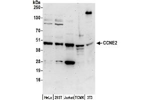 anti-Cyclin E2 (CCNE2) (AA 354-404) antibody