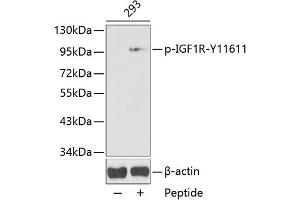 Western blot analysis of extracts from 293 cells, using Phospho-IGF1R-Y1161 antibody (ABIN3020252, ABIN3020253, ABIN3020254 and ABIN1681673). (IGF1R 抗体  (pTyr1161))
