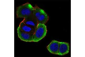 Fig. (CSNK2B 抗体  (AA 1-215))