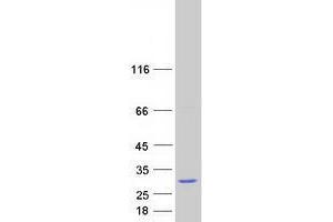 Western Blotting (WB) image for tRNA Phosphotransferase 1 (TRPT1) (Transcript Variant 2) protein (Myc-DYKDDDDK Tag) (ABIN2734398)