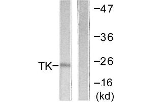 Western blot analysis of extracts from COLO205 cells, using TK (epitope around residue 13) antibody. (TK (N-Term), (Ser13) 抗体)