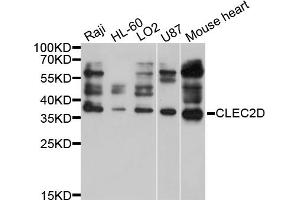 Western blot analysis of extracts of various cell lines, using CLEC2D antibody (ABIN5997460) at 1/1000 dilution. (CLEC2D 抗体)