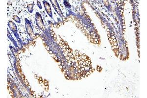 IHC analysis of LOR using anti-LOR antibody (ABIN6719582).