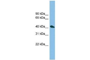 WB Suggested Anti-ZNF514 Antibody Titration: 0. (ZNF514 抗体  (N-Term))