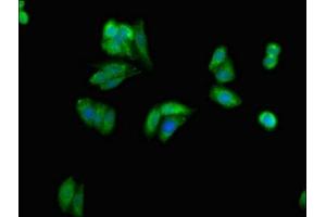 Immunofluorescent analysis of HepG2 cells using ABIN7154494 at dilution of 1:100 and Alexa Fluor 488-congugated AffiniPure Goat Anti-Rabbit IgG(H+L) (PIK3R1 抗体  (AA 15-180))