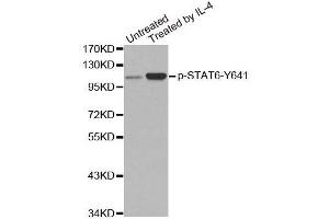Western blot analysis of extracts from Hela cells,using Phospho-STAT6-Y641 antibody. (STAT6 抗体  (pTyr641))