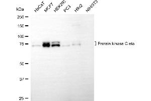anti-Protein Kinase C, eta (PRKCH) antibody