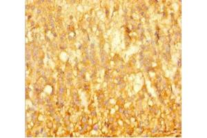 Immunohistochemistry of paraffin-embedded human adrenal gland tissue using ABIN7145808 at dilution of 1:100 (BRD3 抗体  (AA 356-506))