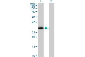 Western Blot analysis of VAPA expression in transfected 293T cell line by VAPA MaxPab polyclonal antibody. (VAPA 抗体  (AA 1-242))