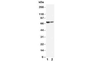 Western blot testing of PMP70 antibody and Lane 1:  rat lung