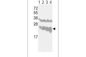 Western blot analysis of UCHL1-V31 in CEM(lane 1), Jurkat(lane 2), Y79(lane 3) cell line and mouse brain tissue(lane 4) lysates (35ug/lane) (UCHL1 抗体  (N-Term))