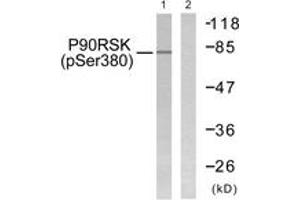 Western Blotting (WB) image for anti-Ribosomal Protein S6 Kinase, 90kDa, Polypeptide 3 (RPS6KA3) (AA 346-395), (pSer380) antibody (ABIN1531363)