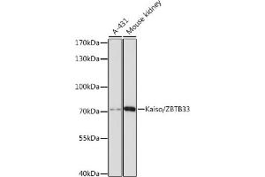 Western blot analysis of extracts of various cell lines, using Kaiso/Kaiso/ZBTB33 antibody  at 1:3000 dilution. (ZBTB33 抗体  (AA 523-672))