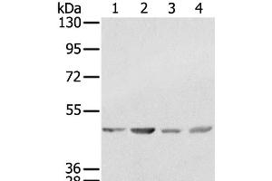 Western Blot analysis of K562, 231, Raji and hela cell using SSB Polyclonal Antibody at dilution of 1:400 (SSB 抗体)