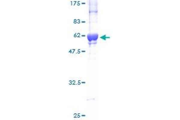 CDK2 Protein (AA 1-298) (GST tag)