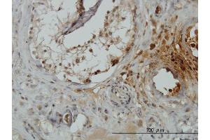 Immunoperoxidase of monoclonal antibody to TRIM49 on formalin-fixed paraffin-embedded human testis. (TRIM49 抗体  (AA 251-340))
