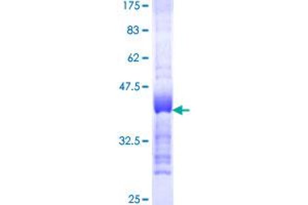 TACC3 Protein (AA 1-100) (GST tag)