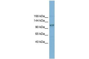 WB Suggested Anti-CCDC87 Antibody Titration: 0. (CCDC87 抗体  (N-Term))
