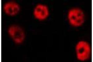 ABIN6275339 staining HepG2 by IF/ICC. (PRRX1 抗体  (Internal Region))