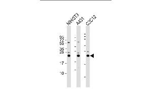 All lanes : Anti-RAB7 Antibody (C-term) at 1:2000 dilution Lane 1: NIH/3T3 whole cell lysate Lane 2: A431 whole cell lysate Lane 3: C2C12 whole cell lysate Lysates/proteins at 20 μg per lane. (RAB7A 抗体  (C-Term))