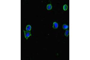 Immunofluorescent analysis of MCF-7 cells using ABIN7147459 at dilution of 1:100 and Alexa Fluor 488-congugated AffiniPure Goat Anti-Rabbit IgG(H+L) (CERKL 抗体  (AA 1-558))