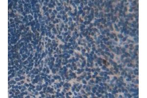 Immunohistochemistry (IHC) image for anti-Growth Factor Receptor-Bound Protein 7 (GRB7) (AA 298-489) antibody (ABIN7439495)