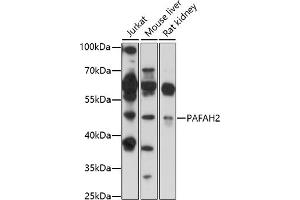 Western blot analysis of extracts of various cell lines, using P antibody (ABIN7269402) at 1:1000 dilution. (PAFAH2 抗体  (AA 260-350))