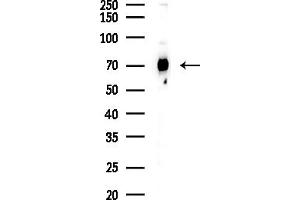 Western blot analysis of lysates from COLO205 cells(UV,30 min treatment), using Grp75 Antibody at 1/1000 dilution.