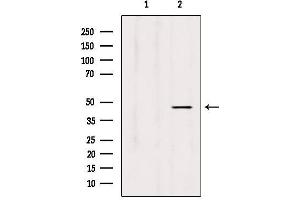 Western blot analysis of extracts from Hela, using L2HGDH Antibody. (L2HGDH 抗体  (Internal Region))