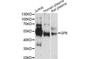 Western blot analysis of extracts of various cell lines, using GP6 antibody (ABIN6293681) at 1:1000 dilution. (GP6 抗体)