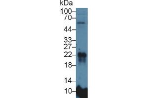 Western Blot; Sample: Rat Lung lysate; Primary Ab: 5µg/ml Rabbit Anti-Rat MFAP5 Antibody Second Ab: 0. (MFAP5 抗体  (AA 32-164))