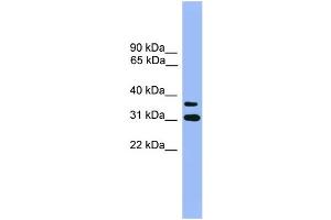 WB Suggested Anti-OR2D3 Antibody Titration: 1. (OR2D3 抗体  (C-Term))
