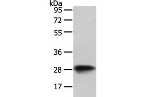 Gel: 8 % SDS-PAGE, Lysate: 40 μg, Lane: NIH/3T3 cell, Primary antibody: ABIN7128073(VAPA Antibody) at dilution 1/400 dilution, Secondary antibody: Goat anti rabbit IgG at 1/8000 dilution, Exposure time: 1 second (VAPA 抗体)