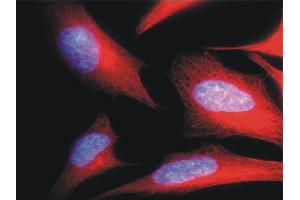 Immunofluorescence staining of HeLa human cervix carcinoma cell line using anti-alpha-tubulin (; red). (alpha Tubulin 抗体  (Biotin))
