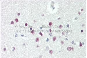 Rabbit Anti-TBX15 antibody   Formalin Fixed Paraffin Embedded Tissue: Human Adult Brain, cortex  Observed Staining: Cytoplasm in hepatocytes Primary Antibody Concentration: 1:600 Secondary Antibody: Donkey anti-Rabbit-Cy3 Secondary Antibody Concentration: 1:200 Magnification: 20X Exposure Time: 0. (T-Box 15 抗体  (C-Term))