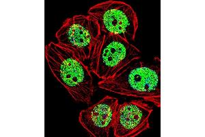 Fluorescent confocal image of A549 cell stained with FOXG1 Antibody (Center) (ABIN653750 and ABIN2843050). (FOXG1 抗体  (AA 225-252))
