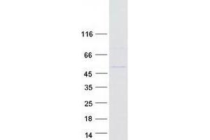 Validation with Western Blot