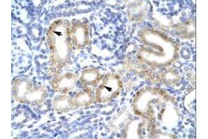 Image no. 1 for anti-T-Box 1 (TBX1) (AA 396-445) antibody (ABIN202658) (T-Box 1 抗体  (AA 396-445))