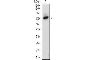 Western blot analysis using ZAP70 mouse mAb against MOLT4 (1) cell lysate. (ZAP70 抗体  (AA 169-390))