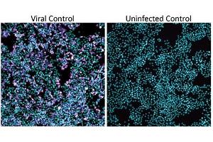 Biosafety Level 3 (BSL-3) SARS-CoV-2 bioassay in H1437 cells with washout step and raw infectivity of H1437 cells by SARS-CoV-2 WA1 strain. (SARS-CoV-2 Nucleocapsid 抗体)