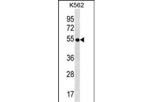 LAX1 Antibody (C-term) (ABIN1537207 and ABIN2850101) western blot analysis in K562 cell line lysates (35 μg/lane). (LAX1 抗体  (C-Term))