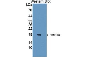 Western blot analysis of the recombinant protein. (CXCL9 抗体  (AA 22-125))