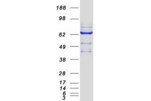 Western Blotting (WB) image for Guanine Monophosphate Synthetase (GMPS) protein (Myc-DYKDDDDK Tag) (ABIN2722092)