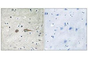 Immunohistochemistry (IHC) image for anti-MAP-Kinase Activating Death Domain (MADD) (Internal Region) antibody (ABIN1849836) (MADD 抗体  (Internal Region))