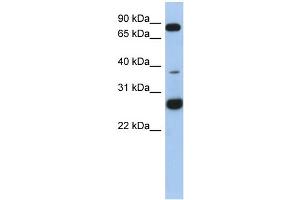 WB Suggested Anti-C1orf110 Antibody Titration: 0. (C1ORF110 抗体  (N-Term))
