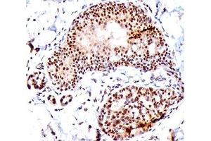 IHC staining of human tonsil with SUMO1 antibody (SM1/495). (SUMO1 抗体)