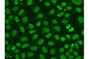 Immunofluorescence analysis of HeLa cells using FEN1 antibody. (FEN1 抗体)