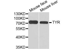 Western blot analysis of extracts of various cell lines, using TYR antibody. (TYR 抗体  (AA 20-340))